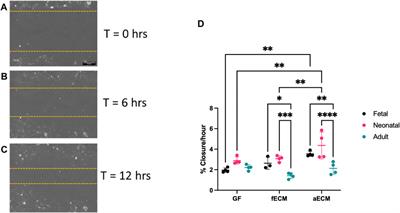 Characterization of cardiac fibroblast-extracellular matrix crosstalk across developmental ages provides insight into age-related changes in cardiac repair